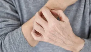 خطاهای رایج پوستی در هوای سرد
