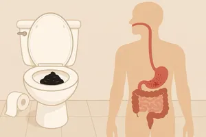 مدفوع سیاه؛ چه زمانی طبیعی و چه زمانی نشانه خونریزی است؟
