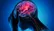 چرا سکته مغزی در ایران زودتر سراغ افراد می‌آید؟
