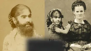 نوزادی که با سبیل به دنیا آمد! داستان عجیب ترین ستاره سیرک های جهان (+عکس)