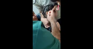 اتفاق عجیب برای کودک ۵ ساله در ترکیه؛ کنه داخل گوشش لانه کرده بود